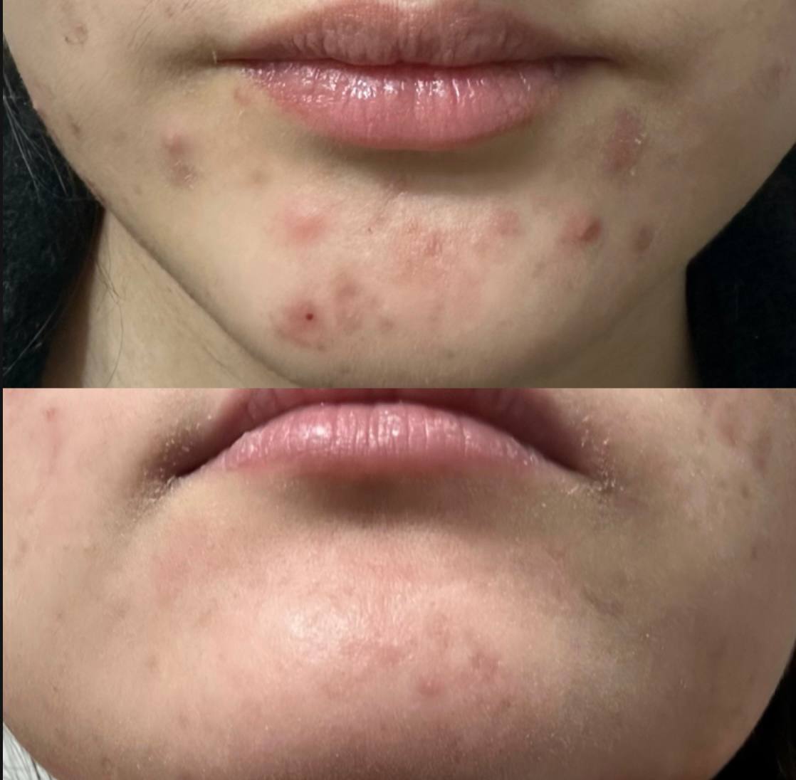 Aisha — teri barerini tikladı 🛡️💆🏻‍♀️